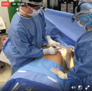Facebook live surgery